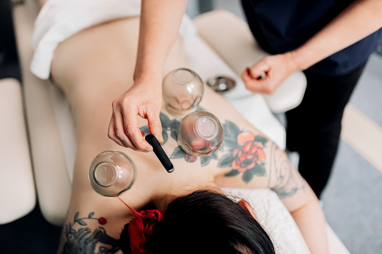 Moksibustio ja kuivakuppaus osana kivunhoitoa.